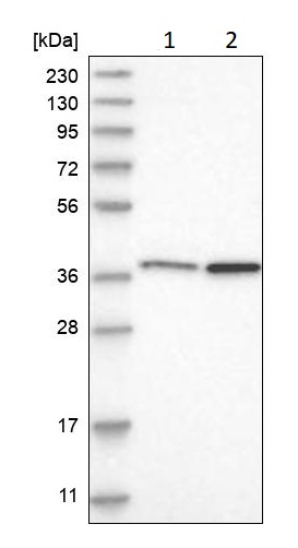 Western blot - Anti-MECR antibody (AB254707), expandable thumbnail