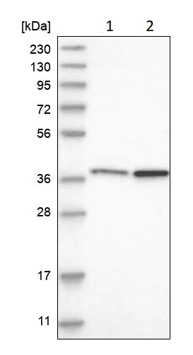 Western blot - Anti-MECR antibody (AB254707)