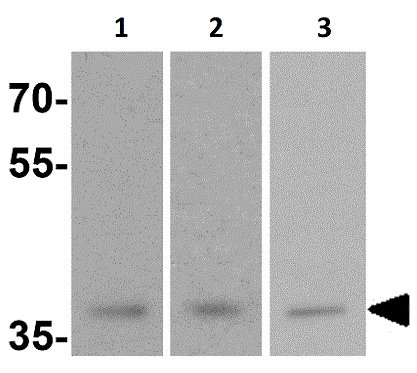 Western blot - Anti-MECR antibody - C-terminal (AB156268)