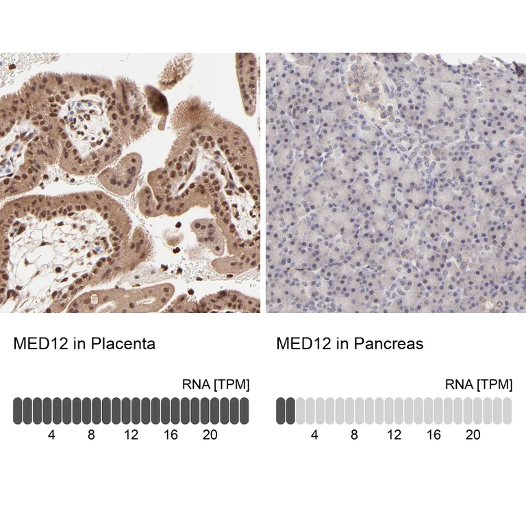 Immunohistochemistry (Formalin/PFA-fixed paraffin-embedded sections) - Anti-MED12 Antibody (AB327176)