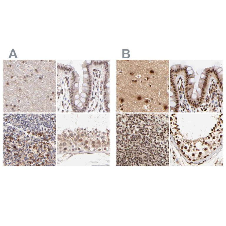 Immunohistochemistry (Formalin/PFA-fixed paraffin-embedded sections) - Anti-MED12 Antibody (AB327176)