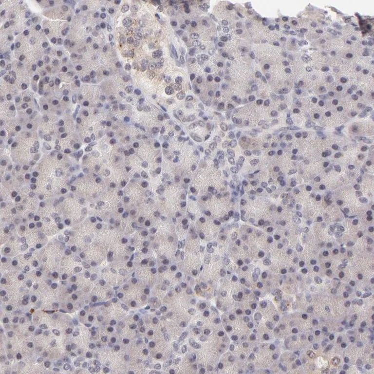 Immunohistochemistry (Formalin/PFA-fixed paraffin-embedded sections) - Anti-MED12 Antibody (AB327176)