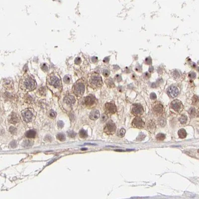 Immunohistochemistry (Formalin/PFA-fixed paraffin-embedded sections) - Anti-MED12 Antibody (AB327176)