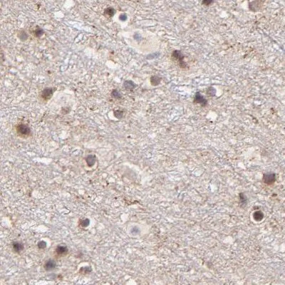 Immunohistochemistry (Formalin/PFA-fixed paraffin-embedded sections) - Anti-MED12 Antibody (AB327176)
