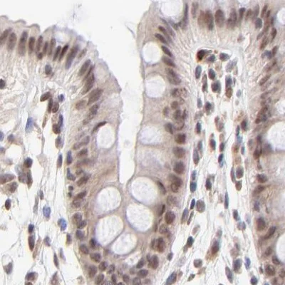 Immunohistochemistry (Formalin/PFA-fixed paraffin-embedded sections) - Anti-MED12 Antibody (AB327176)