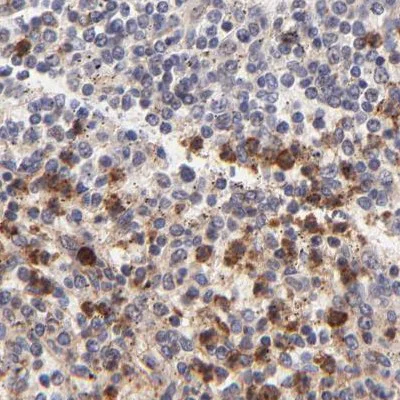 Immunohistochemistry (Formalin/PFA-fixed paraffin-embedded sections) - Anti-MED12 Antibody (AB327176)