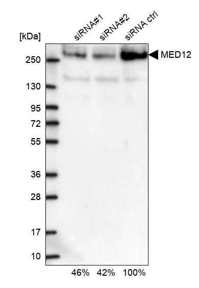 Western blot - Anti-MED12 Antibody (AB327176)