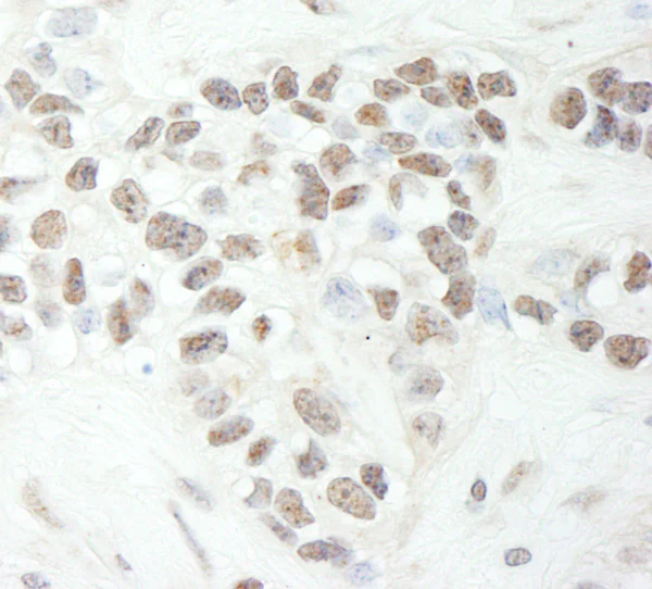 Immunohistochemistry (Formalin/PFA-fixed paraffin-embedded sections) - Anti-MED12 antibody (AB70842)