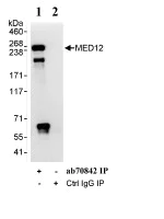 Immunoprecipitation - Anti-MED12 antibody (AB70842)
