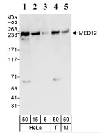 Anti-MED12 antibody