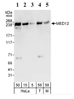 Western blot - Anti-MED12 antibody (AB70842)