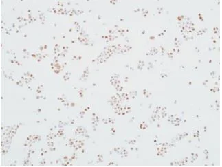 Immunocytochemistry - Anti-MED12 antibody [BLR084G] (AB275962)