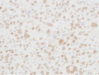 Immunohistochemistry (Formalin/PFA-fixed paraffin-embedded sections) - Anti-MED12 antibody [BLR084G] (AB275962)