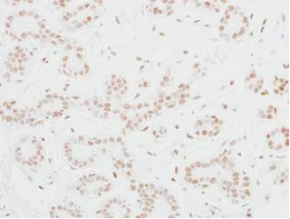 Immunohistochemistry (Formalin/PFA-fixed paraffin-embedded sections) - Anti-MED12 antibody [BLR084G] (AB275962)