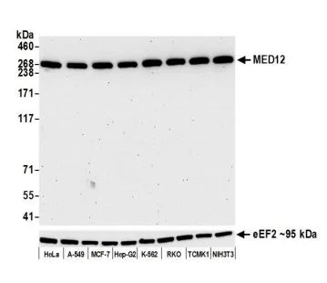 Western blot - Anti-MED12 antibody [BLR084G] (AB275962)
