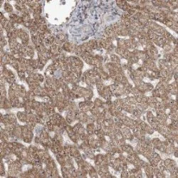 Immunohistochemistry (Formalin/PFA-fixed paraffin-embedded sections) - Anti-MED12L antibody (AB122368)
