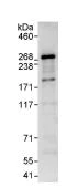 Immunoprecipitation - Anti-MED13L antibody (AB87831)