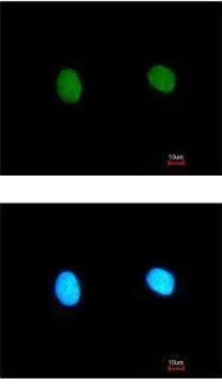 Immunocytochemistry/ Immunofluorescence - Anti-MED18 antibody (AB228887)