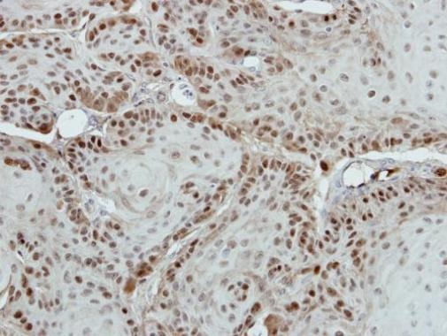 Immunohistochemistry (Formalin/PFA-fixed paraffin-embedded sections) - Anti-MED18 antibody (AB228887)