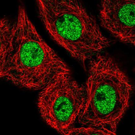 Immunocytochemistry/ Immunofluorescence - Anti-MED25 antibody (AB221741)