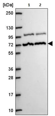 Western blot - Anti-MED25 antibody (AB221741)