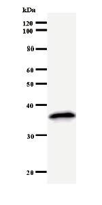 Western blot - Anti-MED26 antibody [2216C1a] (AB50619)
