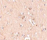 Immunohistochemistry (Formalin/PFA-fixed paraffin-embedded sections) - Anti-MED28/EG1 antibody (AB73294)