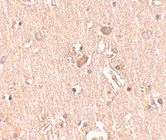 Immunohistochemistry (Formalin/PFA-fixed paraffin-embedded sections) - Anti-MED28/EG1 antibody (AB73294)