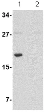 Western blot - Anti-MED28/EG1 antibody (AB73294)