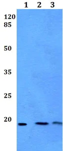 Western blot - Anti-MED30 / TRAP25 antibody (AB192523)