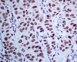Immunohistochemistry (Formalin/PFA-fixed paraffin-embedded sections) - Anti-MED4 antibody [EPR7816] (AB129170)