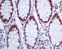 Immunohistochemistry (Formalin/PFA-fixed paraffin-embedded sections) - Anti-MED4 antibody [EPR7816] - BSA and Azide free (AB248327), expandable thumbnail