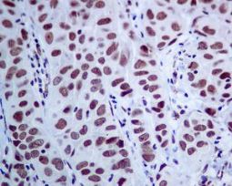 Immunohistochemistry (Formalin/PFA-fixed paraffin-embedded sections) - Anti-MED4 antibody [EPR7816] - BSA and Azide free (AB248327), expandable thumbnail