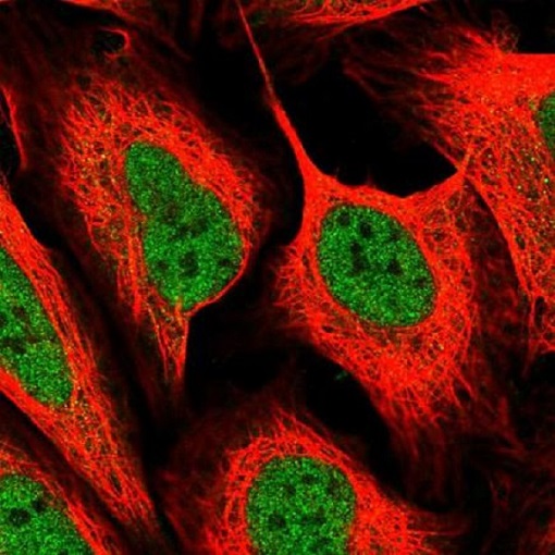 Immunocytochemistry/ Immunofluorescence - Anti-MED6 antibody (AB220110), expandable thumbnail