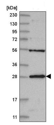 Western blot - Anti-MED6 antibody (AB220110), expandable thumbnail