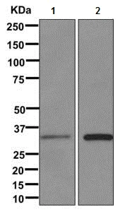 Western blot - Anti-MED6 antibody [EPR12107] (AB172605)
