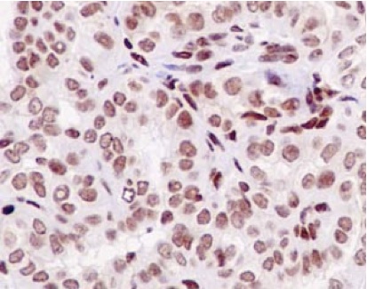 Immunohistochemistry (Formalin/PFA-fixed paraffin-embedded sections) - Anti-MED7 antibody [EPR15410] (AB187146)