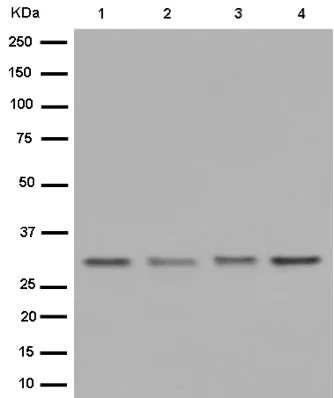 Western blot - Anti-MED7 antibody [EPR15410] - BSA and Azide free (AB250909)