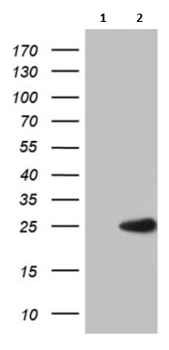 Western blot - Anti-MED9 antibody [OTI7F11] (AB236399), expandable thumbnail