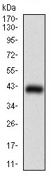 Western blot - Anti-MEF2A antibody [2F9H2] (AB181494), expandable thumbnail