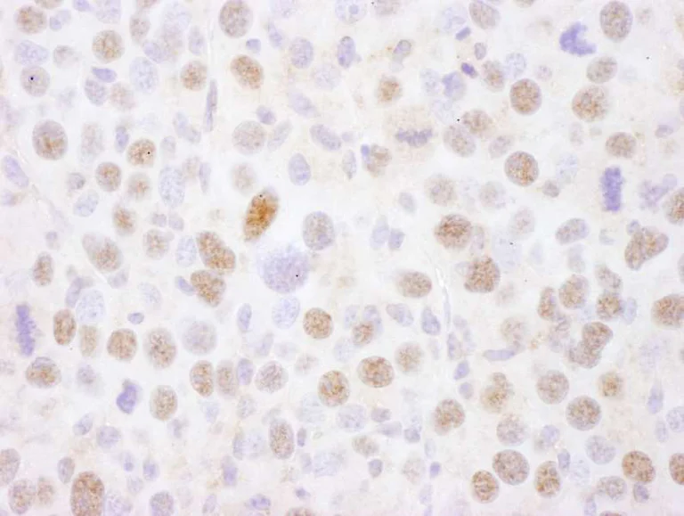 Immunohistochemistry (Formalin/PFA-fixed paraffin-embedded sections) - Anti-MEF2A antibody (AB264329)