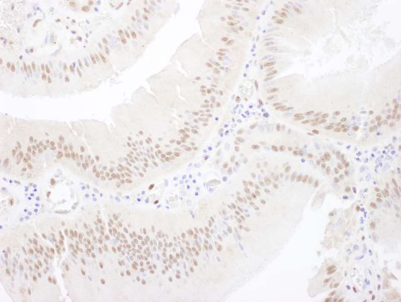 Immunohistochemistry (Formalin/PFA-fixed paraffin-embedded sections) - Anti-MEF2A antibody (AB264329), expandable thumbnail