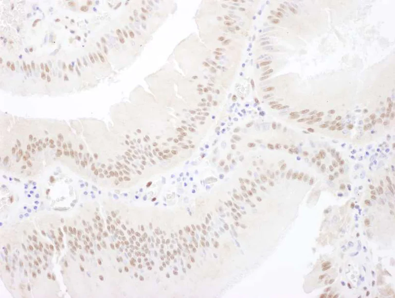 Immunohistochemistry (Formalin/PFA-fixed paraffin-embedded sections) - Anti-MEF2A antibody (AB264329)