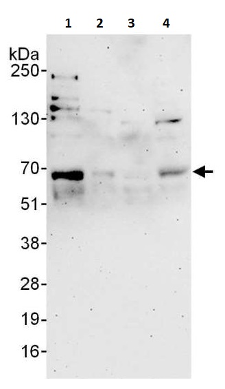 Western blot - Anti-MEF2A antibody (AB264329), expandable thumbnail