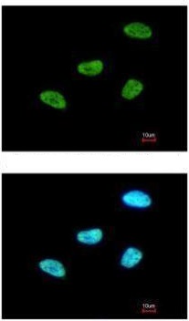 Immunocytochemistry/ Immunofluorescence - Anti-MEF2A antibody - C-terminal (AB227120), expandable thumbnail