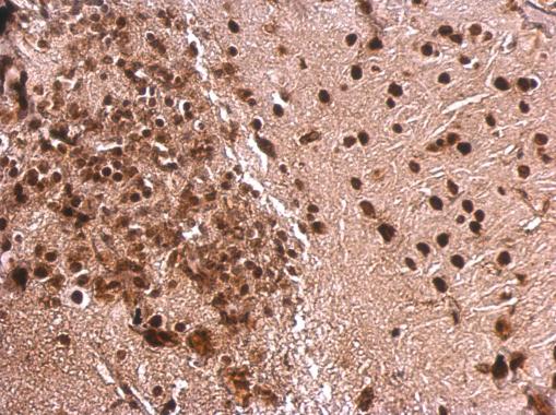 Immunohistochemistry (Formalin/PFA-fixed paraffin-embedded sections) - Anti-MEF2A antibody - C-terminal (AB227120), expandable thumbnail