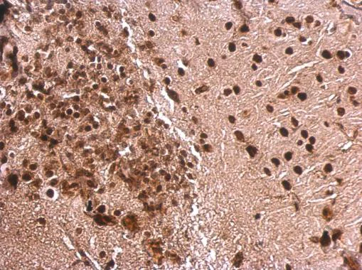 Immunohistochemistry (Formalin/PFA-fixed paraffin-embedded sections) - Anti-MEF2A antibody - C-terminal (AB227120)