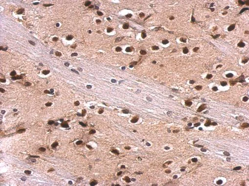 Immunohistochemistry (Formalin/PFA-fixed paraffin-embedded sections) - Anti-MEF2A antibody - C-terminal (AB227120)