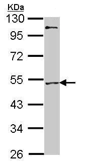 Western blot - Anti-MEF2A antibody - C-terminal (AB227120)
