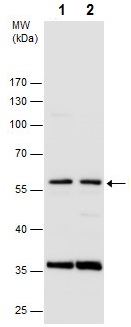 Western blot - Anti-MEF2A antibody - C-terminal (AB227120), expandable thumbnail